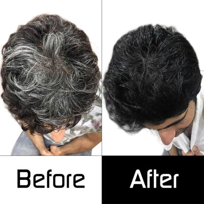 Shampoo Anti-Canas- HOY ULTIMAS 20 UNIDADES HASTA LIQUIDAR STOCK